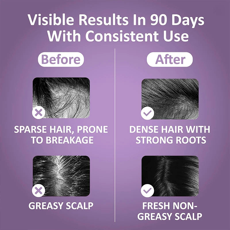 Electric Head Massage Comb Head Vibration Massager Portable Hair Follicle Comb Scalp Oil Liquid Applicator Hair Growth Anti Loss