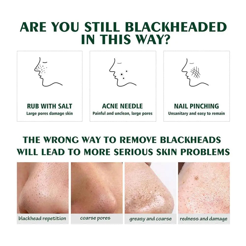 White Blackhead Remover Cream Paper Plant Pore Strips Nose Acne Cleansing Black Dots Peel Off Mud Mask Treatments Skin Care 30g